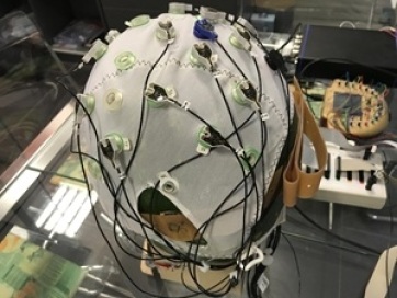 Epilepsziás betegek számára fejlesztenek agyi defibrillátort az SZTE kutatói - A cikkhez tartozó kép